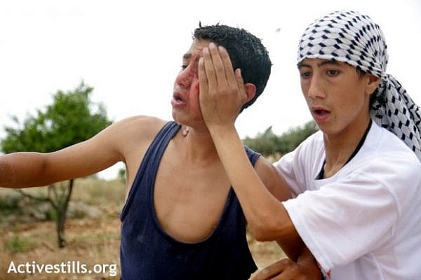 A young Palestinian is seen injured during a protest against the wall in Bilin, april 2004 (photo: Anne Paq/Activestills)