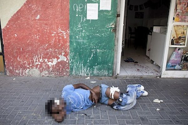 Wounded Eritrean man after knife attack in South Tel AViv July 31, 2012 (Activestills)