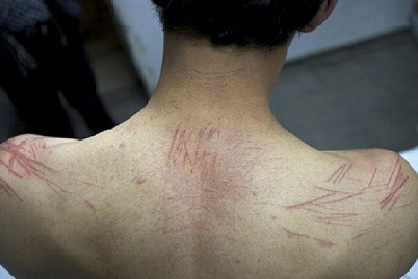 Palestinian Organizer Tortured in Israeli Jail, 23.03.2010 (Anne Paq/Activestills.org)