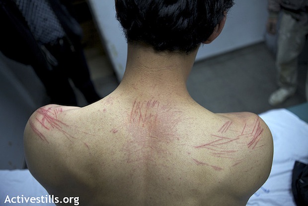 Palestinian organizer tortured in Israeli jail (activestills)