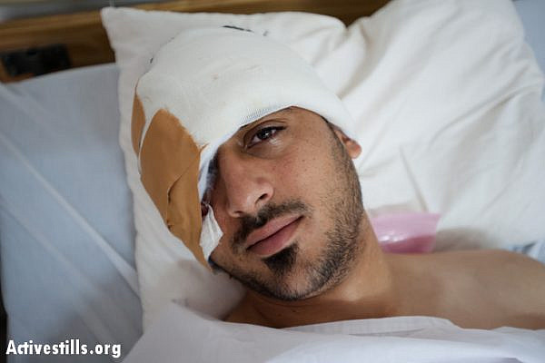 Mohammad Al-Azza rests in the hospital the morning after being shot in the face with a rubber-coated steel bullet by Israeli forces in Aida Refguee Camp. Beit Jala, West Bank, April 9, 2013. Al-Azza underwent two surgeries to remove the bullet, which lodged in his cheek below his right eye and fractured his skull. He is expected to make a full recovery. (Photo by: Ryan Rodrick Beiler/Activestills.org)