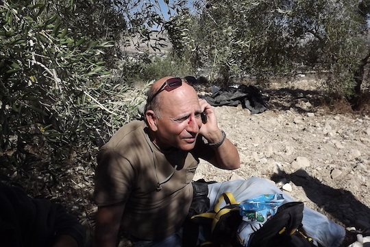 PHOTOS: Settlers attack Palestinian olive pickers, damage trees