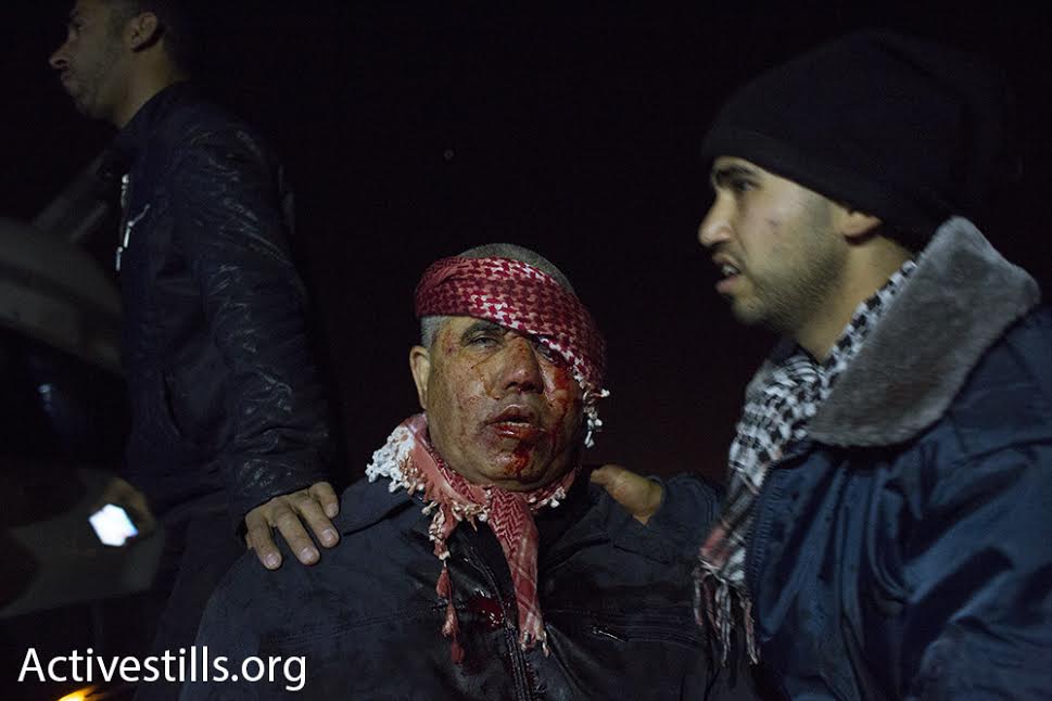 A man bleeds from his head during clashes between Bedouin and Israeli police in the city of Rahat, January 18, 2015. (photo: Oren Ziv/Activestills.org)