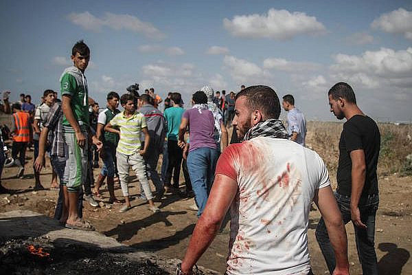 A bloodied Palestinian protester is seen at a protest in the eastern Gaza Strip that left six Palestinians dead and over 130 injured when IDF troops opened fire over the border, Gaza Strip, 9 October, 2015. (Ezz Za'noun)