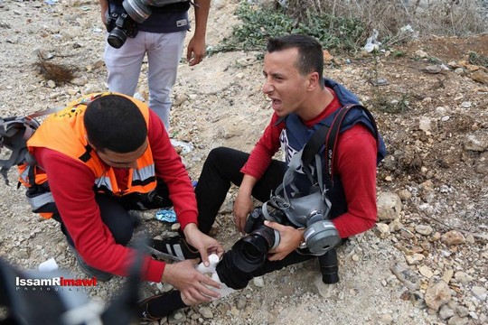 Palestinian photojournalist Samar Nazal is treated after being shot with rubber-coated steel bullets by Israeli troops near Ramallah. (Photo by Issam Rimawi)