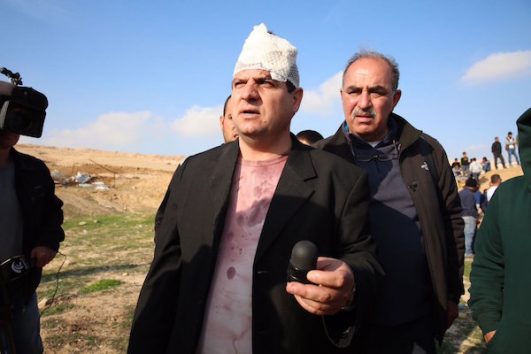MK Ayman Odeh holding the sponge-tipped bullet he says who shot at him by Israeli forces in Umm al-Hiran, January 18, 2017. (Joint List)