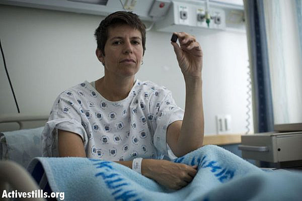 B’Tselem spokesperson Sarit Michaeli, holds a rubber coated bullet, which was taken out of her leg, in Ichilov hospital in Tel Aviv, July 20, 2013. Photo by: Oren Ziv/Activestills.org