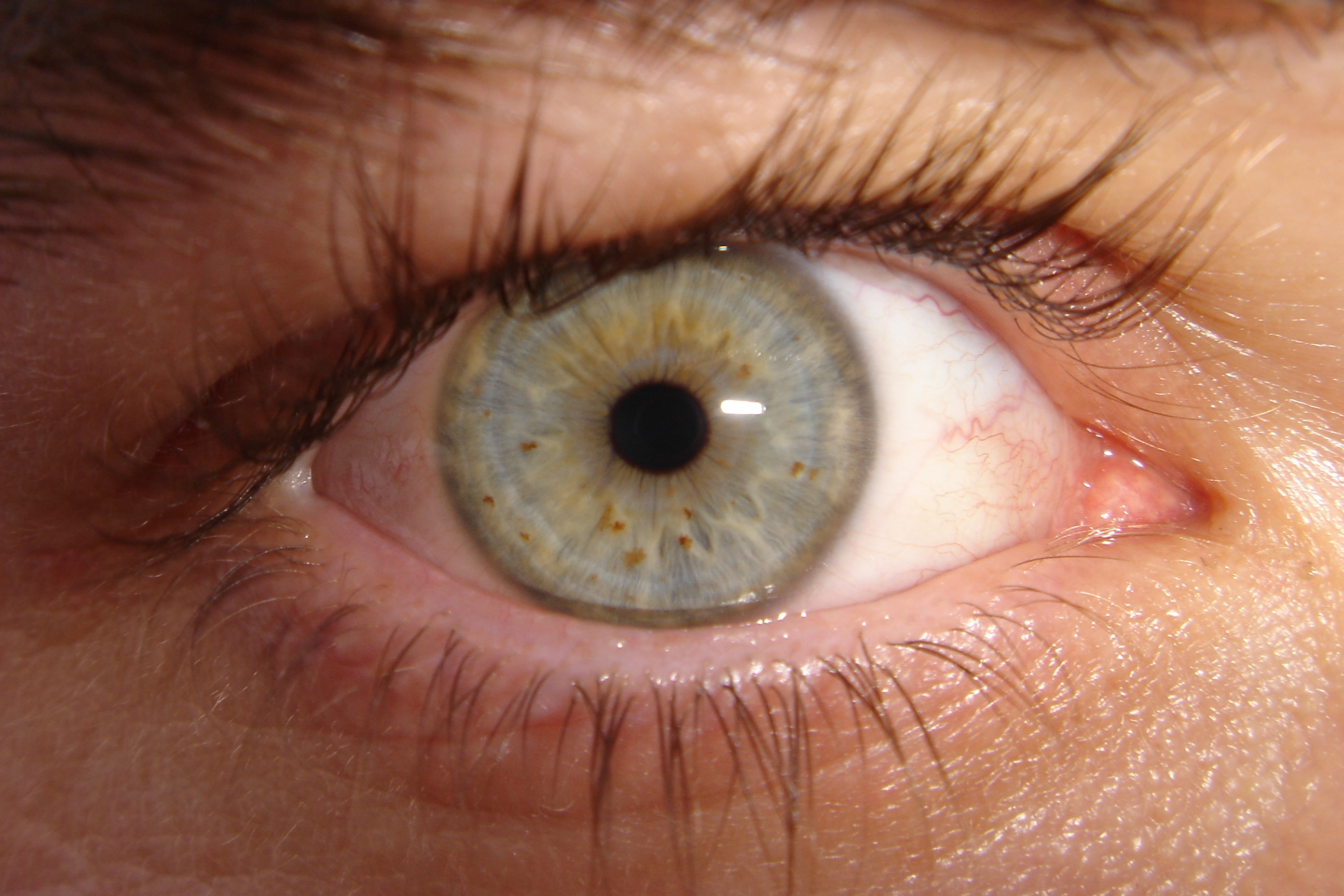 File:Eyeball Blue.jpg - Wikipedia