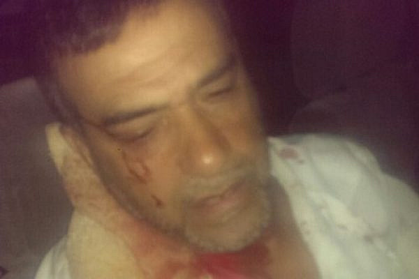 Palestinian resident of Lydd, Amad Abu Sharah, after he was attacked in the early hours of the morning, allegedly by religious Jews. (photo: ledawy.net)