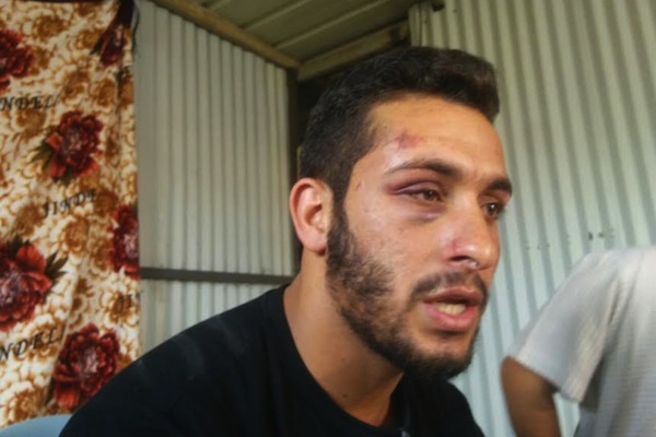 Maysam Abu-Alqiyan pictured after being assaulted by Border Policemen outside a central Tel Aviv supermarket where he works. (photo: Negev Coexistence Forum for Civil Equality)