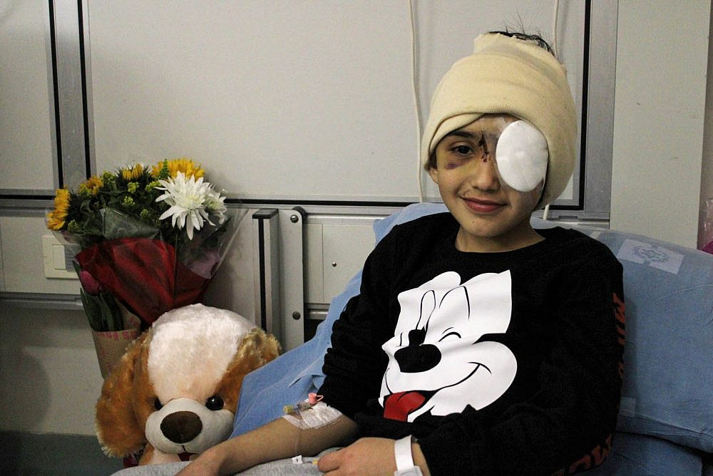 Malek Issa at Hadassah Hospital in Jerusalem. Malek was shot in the eye by a sponge-tipped bullet fired by an Israeli police officer in Issawiya on Feb. 15. (Sharona Weiss/Activestills.org)