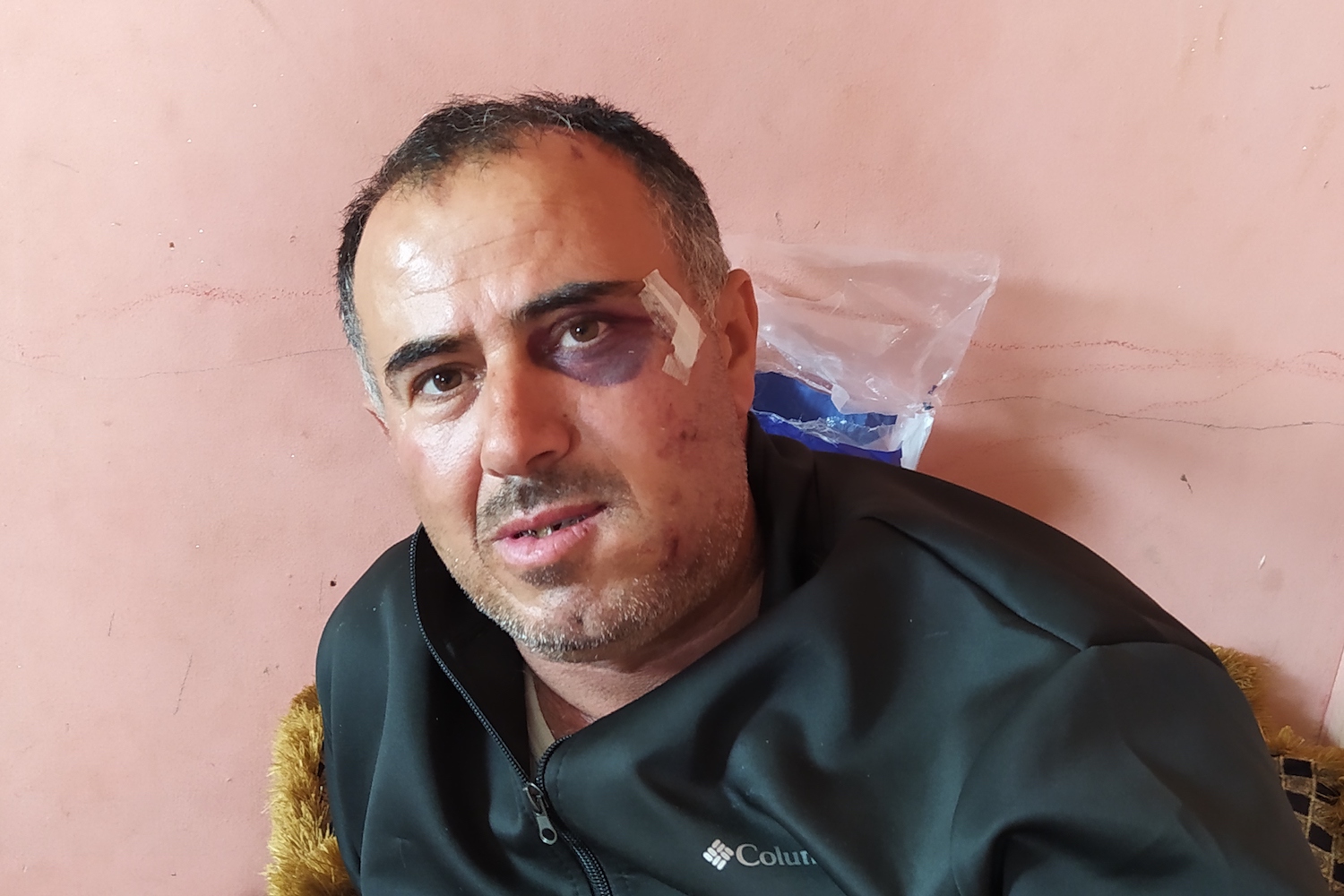 Said Abu Aliyan seen in Hebron's Al-Ahli Hospital after he was attacked by a settler in the South Hebron Hills, West Bank, March 13, 2021. (Guy Butavia)