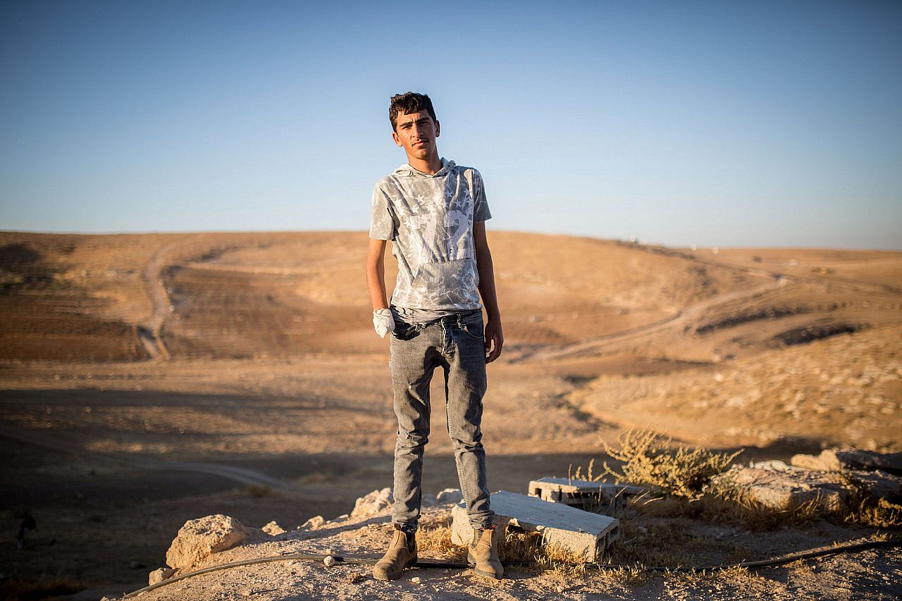 Muhammad Makhamra, whose hand was blown off while shepherding when he stepped on an unexploded grenade left by the Israeli army, Al-Mirkez village, South Hebron Hills, occupied West Bank. (Emily Glick)