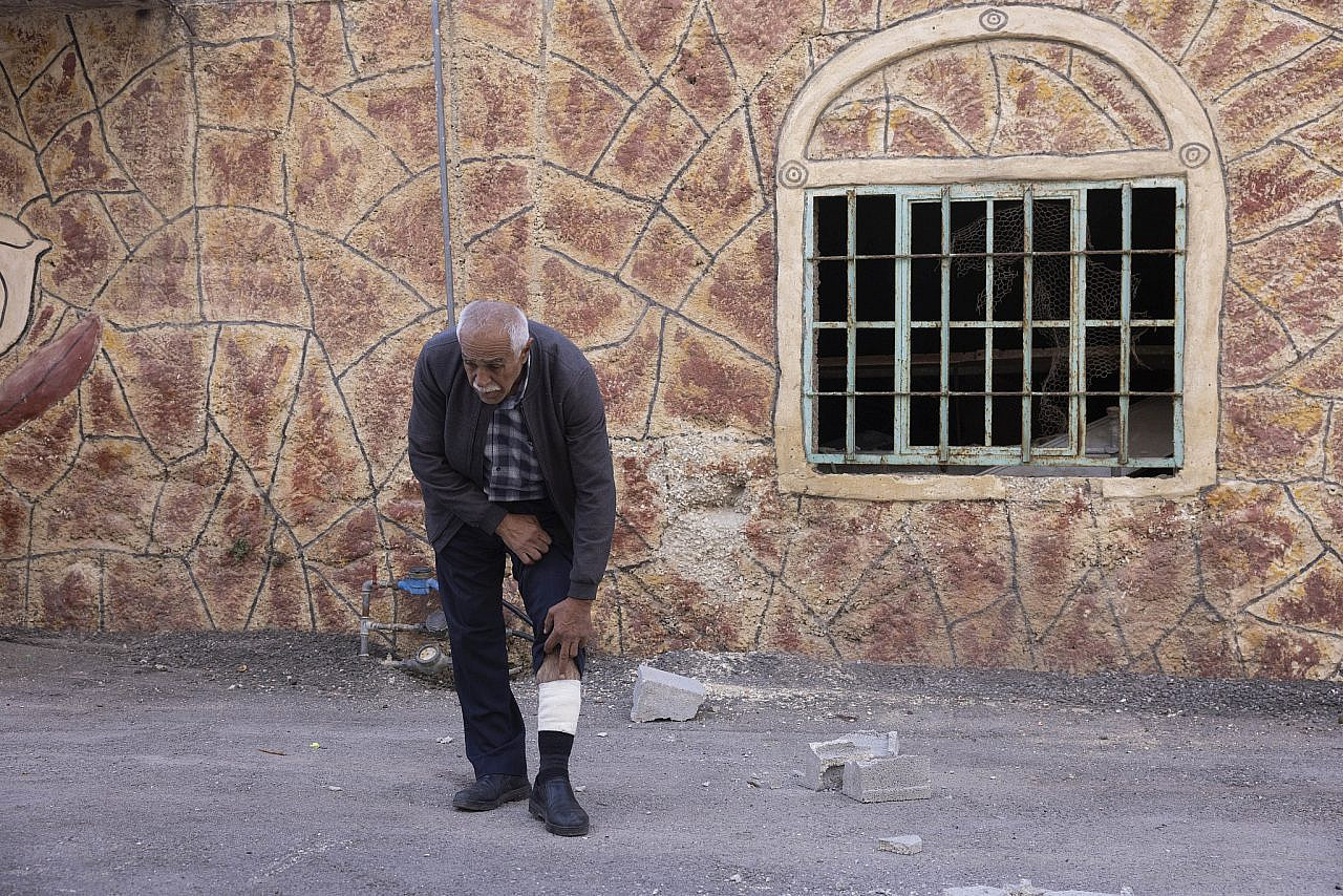 Basem Abu Aysheh, whose leg was injured during an Israeli settler attack, Hebron, occupied West Bank, November 20, 2022. (Oren Ziv)